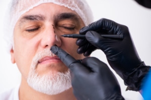 Older man consulting with a male doctor about plastic surgery for a nose job, discussing rhinoplasty options and facial aesthetics.
