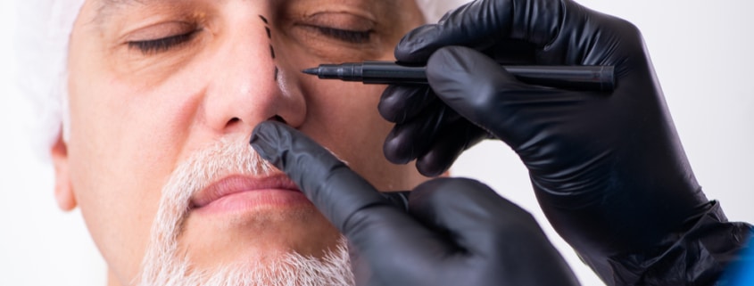 Older man consulting with a male doctor about plastic surgery for a nose job, discussing rhinoplasty options and facial aesthetics.