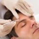 Man receiving Botox injection for wrinkle smoothing and facial rejuvenation at cosmetic clinic