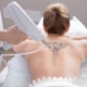 Woman has giant flower tattoo on her back removed by a doctor.